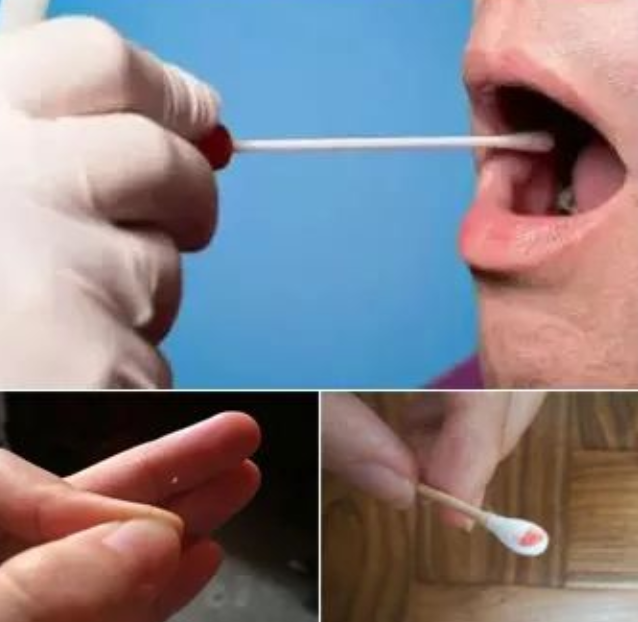 鉴定者邮寄样本到亲子鉴定机构有没有可行性？有哪些好处？