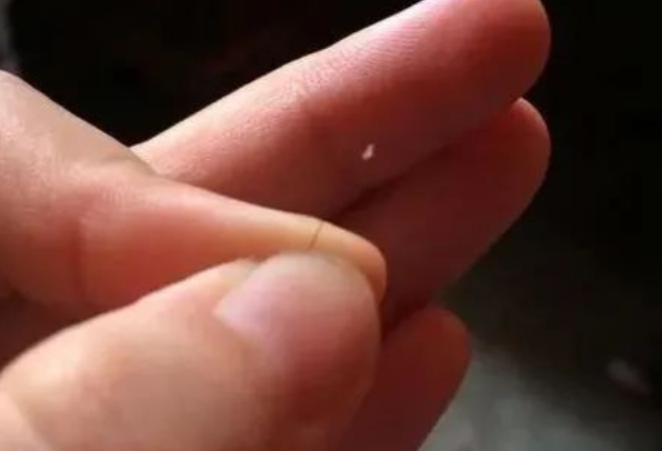 掉落的毛囊毛发可以拿去做染色体亲子鉴定吗？