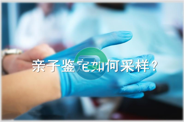 中山亲子鉴定需要注意哪些事项？