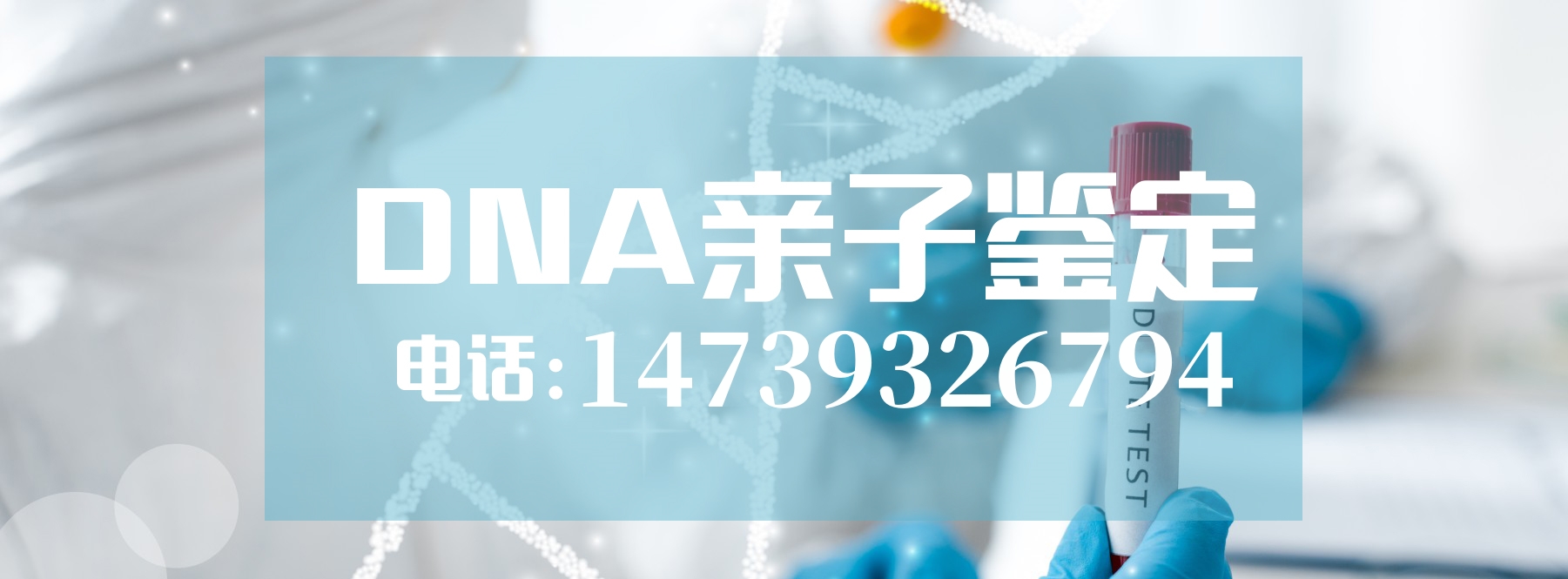 上户口为什么要做中山亲子鉴定？