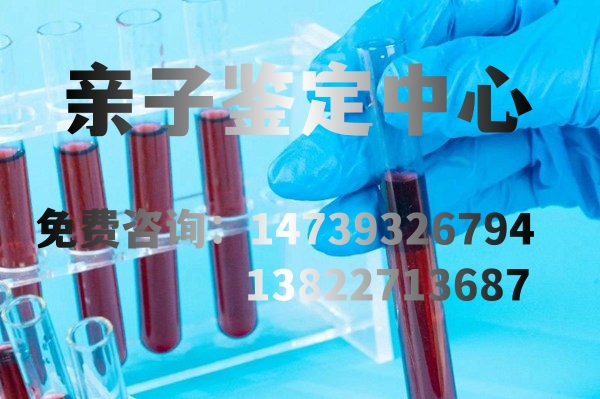中山亲子鉴定是用科学的方法来判断父母与子女之间的亲缘关系