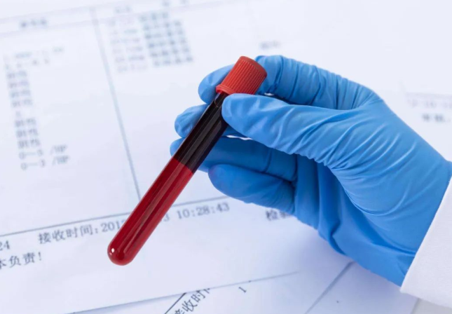 无创胎儿DNA亲子鉴定采血管的注意事项？