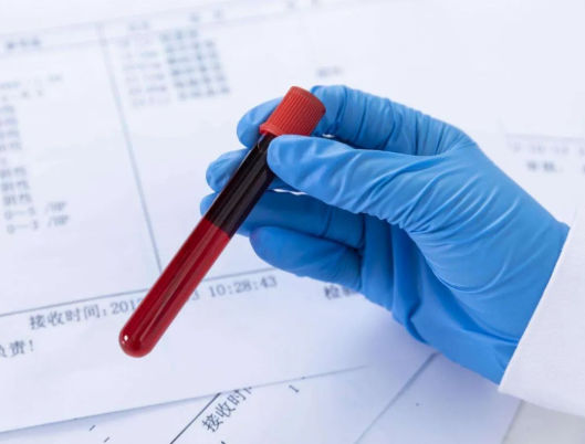 亲子鉴定血型误解和准确率盘点，该如何正确对待？