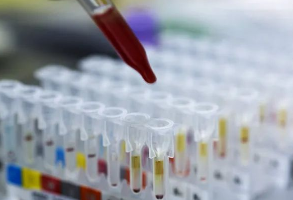 对比血清分类学测试和白细胞抗原测试，亲子（缘）鉴定靠不靠谱？